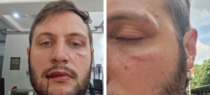 Extrema direita invade a USP, agride estudantes e deve ser enfrentada